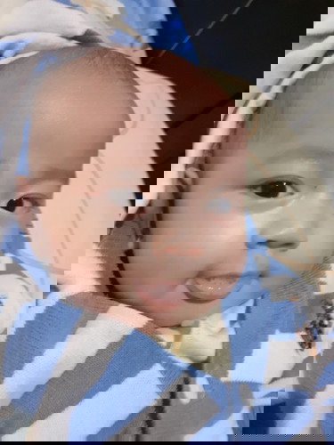 Tahi lalat pada bayi