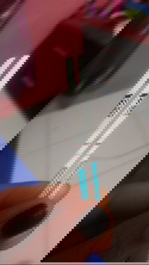 Bentuk janin usia 5 minggu