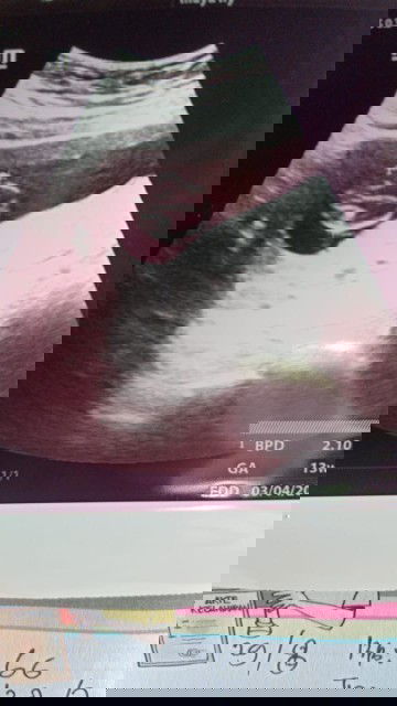 Usia kandungan 13 minggu