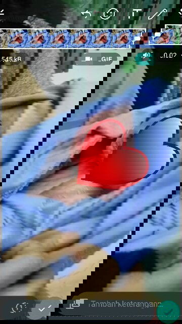 Bayiku meninggal dikandungan usia 37w