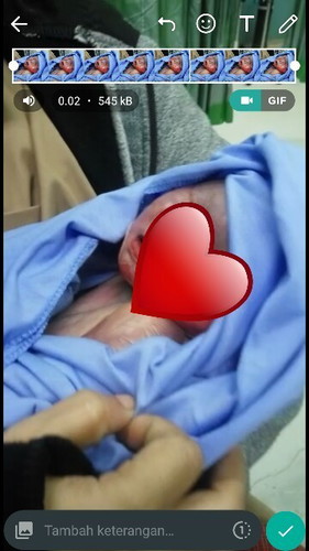 Bayiku meninggal dikandungan usia 37w