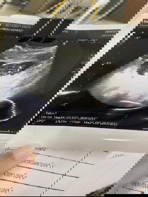 สอบถาาแม่ๆๆๆอายุครรภ์ 14-16 week หน่อย คะ