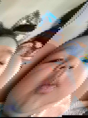 อยากทราบว่าลักษณะแบบนี้น้องจะหัวเบี้ยวมั้ยคะ ?