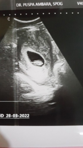 Berapa minggu kehamilan saya saat ini