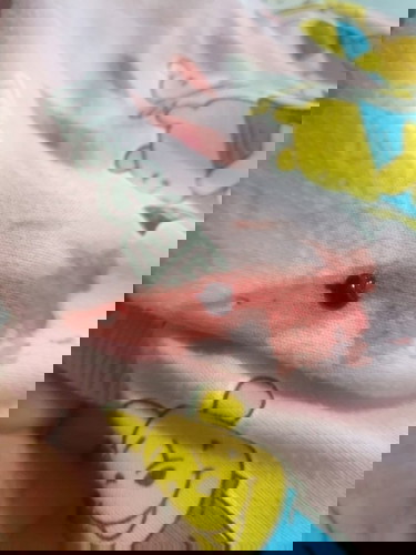 ภาวะแท้งคุกคามสอบถามค่ะ