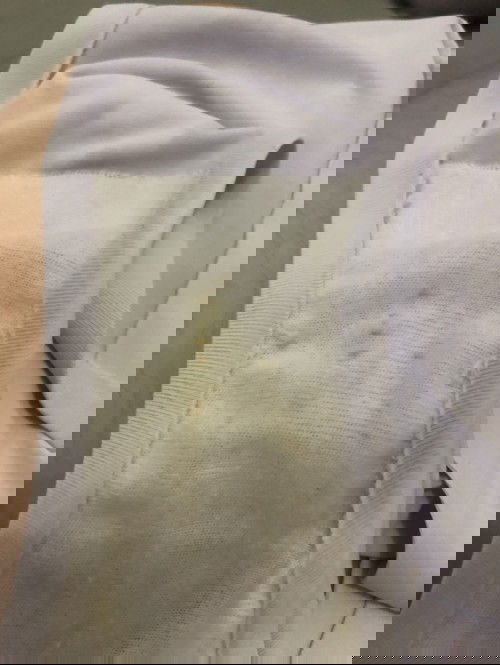 Bercak Kuning dan Nyeri perut