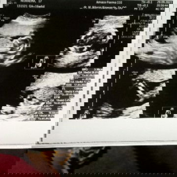 16w4d HPL bulan Maret