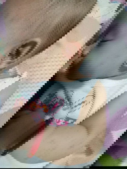 Rashes sa mukha ni baby...