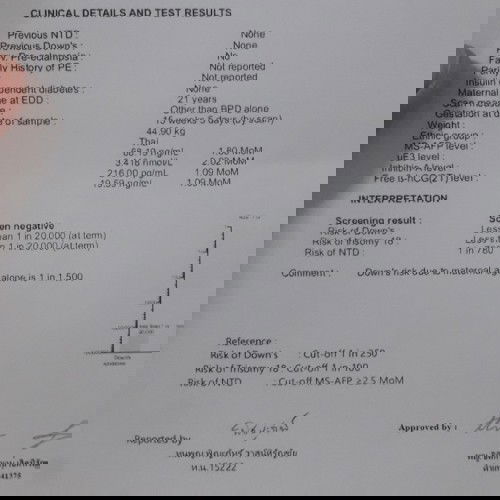 เจาะเลือดตรวจดาวน์ซินโดม