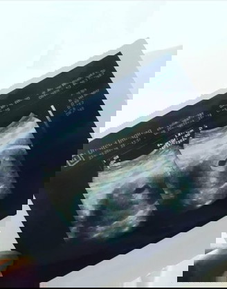 Mohon d bantu bunda?