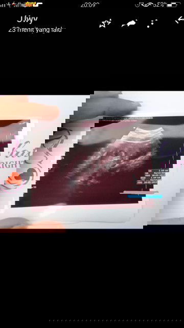 Pengganti ikan apa ya Bun ?