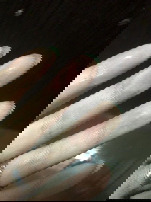 มีตกขาวแบบนี้อันตรายไหมค่ะ