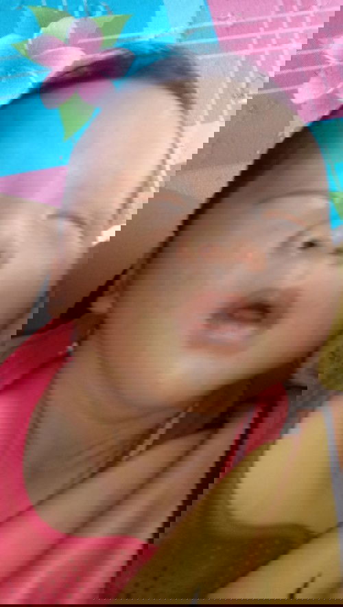 หน้าเป็นผื่นแแบนี้