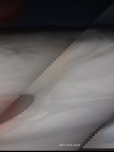 Em 39w ra vậy là sao vậy các mom tập đầu em hồi hợp quá