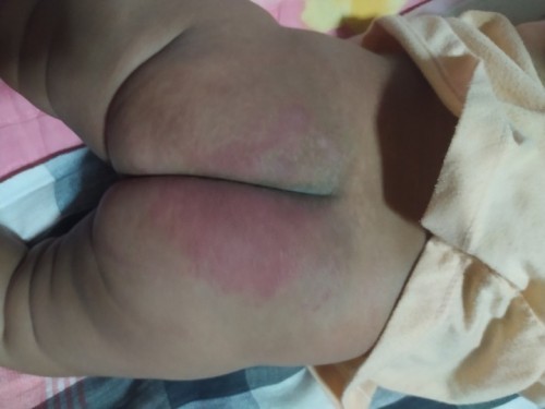 ช่วยด้วย!!