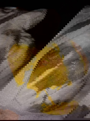 ถ่ายเมือกปนเลือด