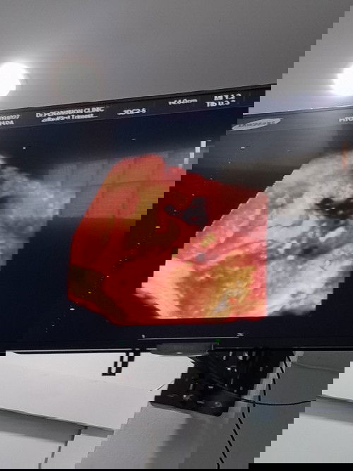 ท้อง37สัปดาห์2วัน ป้าหมอบอกว่าน้องนน.เเค่2300กรัมเอง แม่เครียดมากคะ