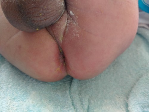 ขอคำแนะนำหน่อยค้าบ🙏