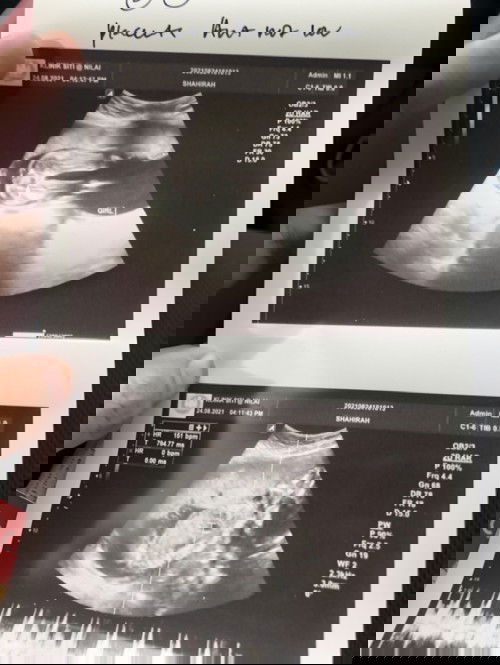 Nampak girl betul2 kan bukan kepit2 boy? 🤣🤣🤣