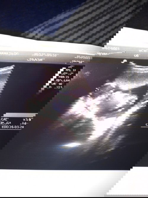 Kehamilan anak pertama moms