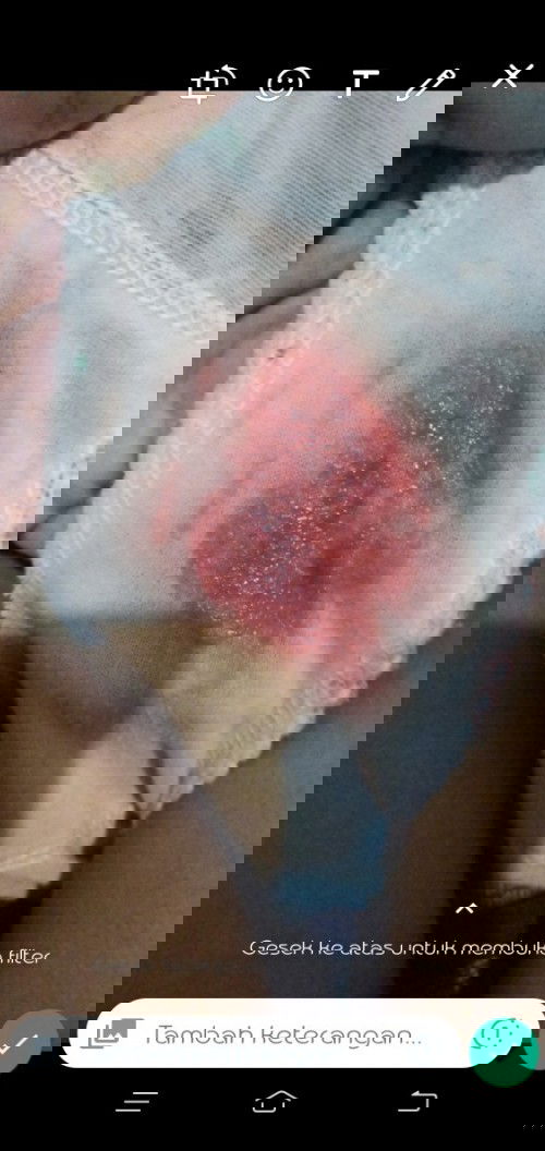 Kluar flek merah mudah hml 11 minggu