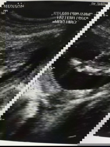 น้อง ญหรือช คะ