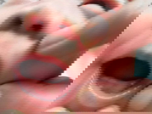 Teething at 1 month old