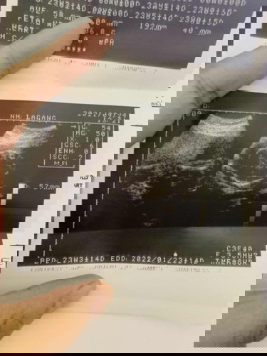 Tanong lan po. Boy or girl?