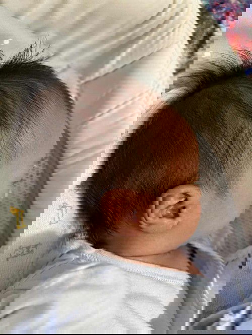 Head Shape of Newborn Baby