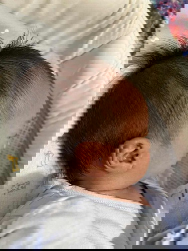 Head Shape of Newborn Baby