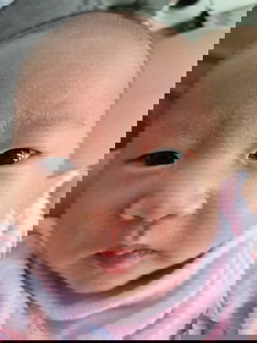 Scaly skin between eye brows
