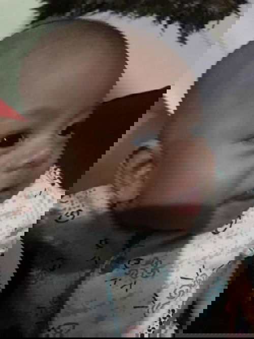 Kepala peyang usia 2 bln