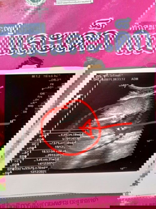 หญิงหรือชาย #ธีมธันวา64