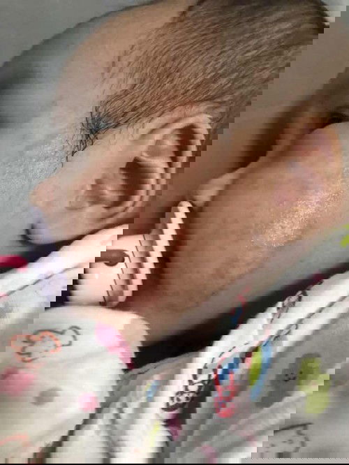 สอบถามผู้มีประสบการณ์ มีผื่นขึ้นที่หน้าลูก