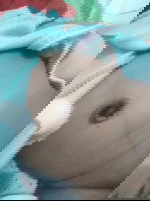 Tali pusat puput belum sempurna