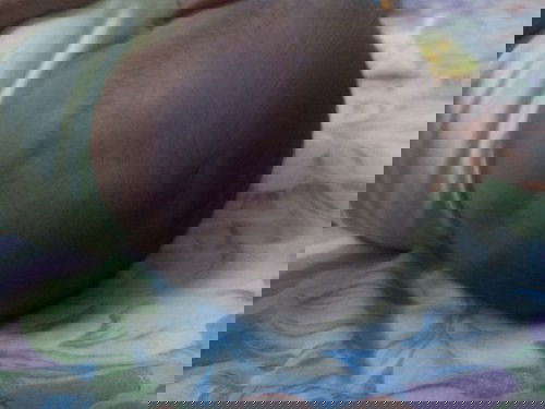 Kepala peyang usia 3bulan 7hari