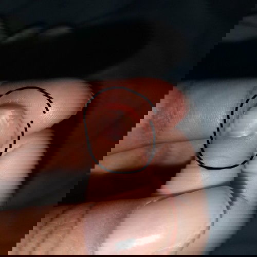 Ibu jari bayi terluka terkena gunting kuku