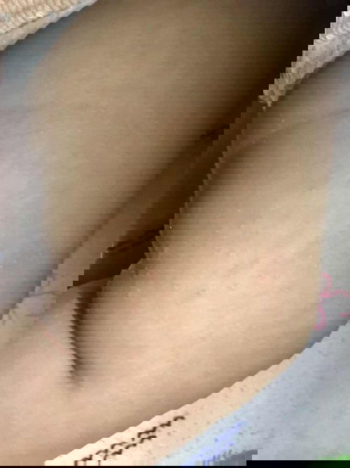 ตุ่มขึ้นตามแขนตามขา