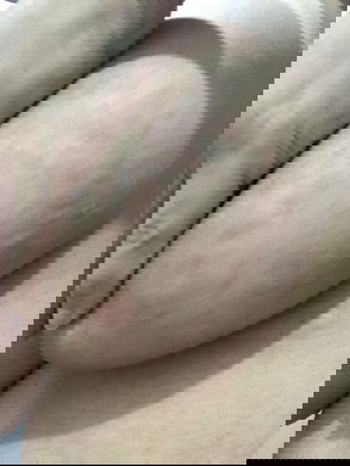 ภาพน่ากลัวนิดนะคะ