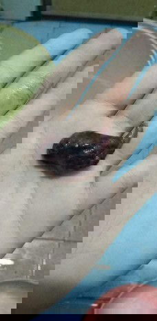 หมอบอกหนูเป็นท้องลม