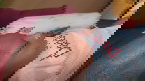 Muka anak banyak merah merah