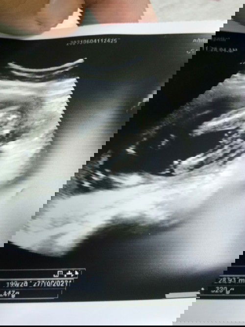 แม่ๆช่วยดูหน่อยนะ ว่าผุ้หญิง รึ ผุ้ชาย ซาวตอน20w  ตอนนี้36+6แล้วจ้า