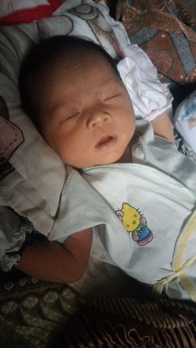 ank sy lakii" bru berumur 11 HR tp d lubang pipis y ada gumpalan putih,ky kapas gt apkh bhya GK y?