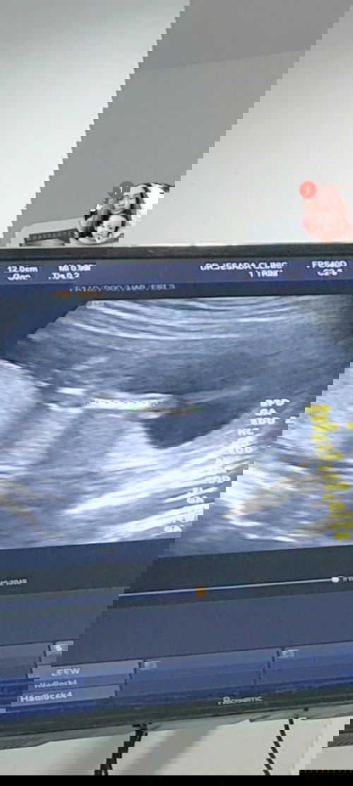 15w3d พอเดาได้มั้ยคะว่าเป็นเพศไหน