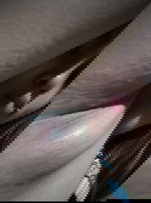 Normal lang po ba tu na may tumubo na bukol sa kili2 masakit talaga sya