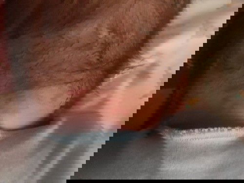 Merah-merah di leher belakang bayi