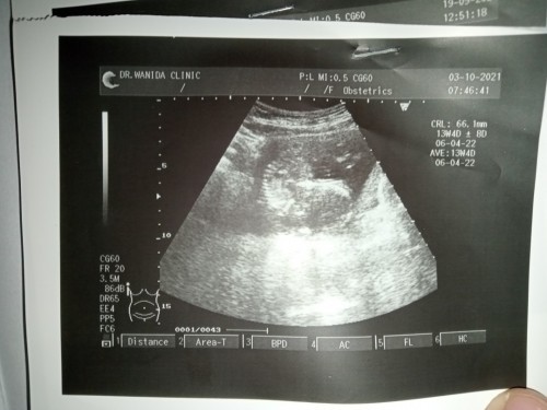 ลูกตัวเล็กไปมั้ยคะ