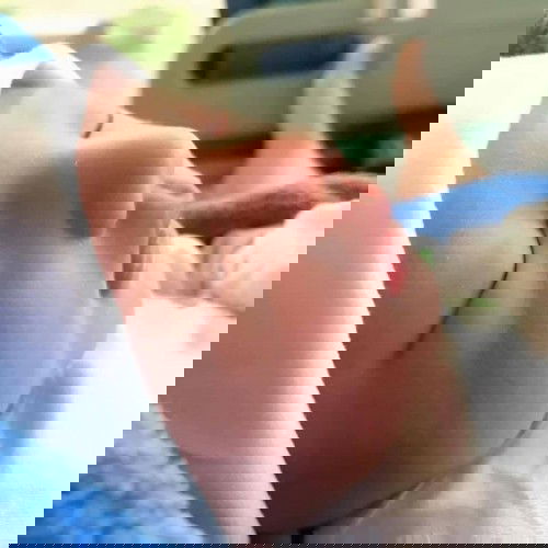 Các mom ơi, e 38w2d bị thiếu ối nên phải mổ. Mom nào mổ rồi cho e chút kinh nghiệm với ạ