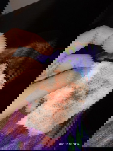 Habis ngeflek beberapa hari keluar darah apakah gpp?