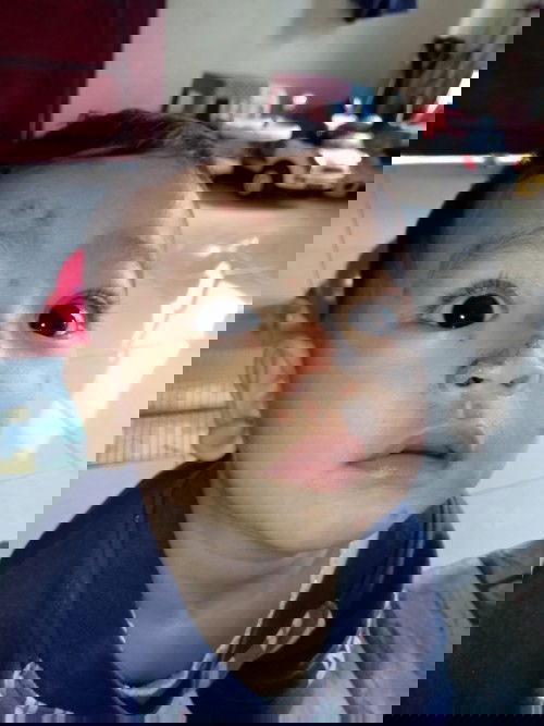 IRITASI JADI INFEKSI